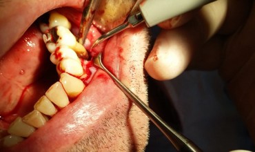 Ağız, Diş ve &Ccedil;ene Cerrahisi