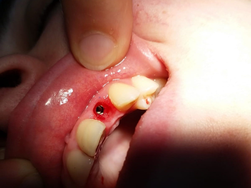 Ağız, Diş ve &Ccedil;ene Cerrahisi