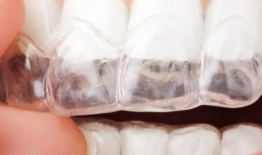 Restoratif Diş Tedavisi